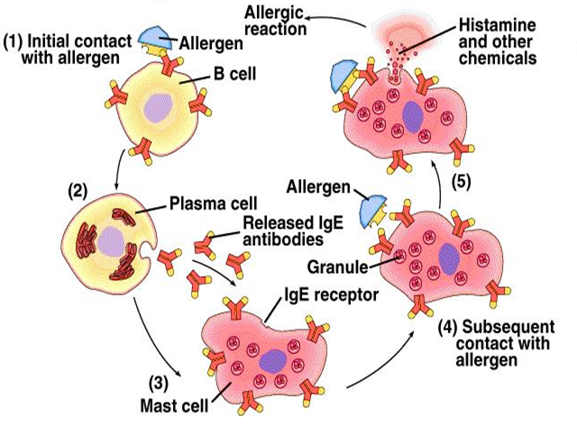 allergy