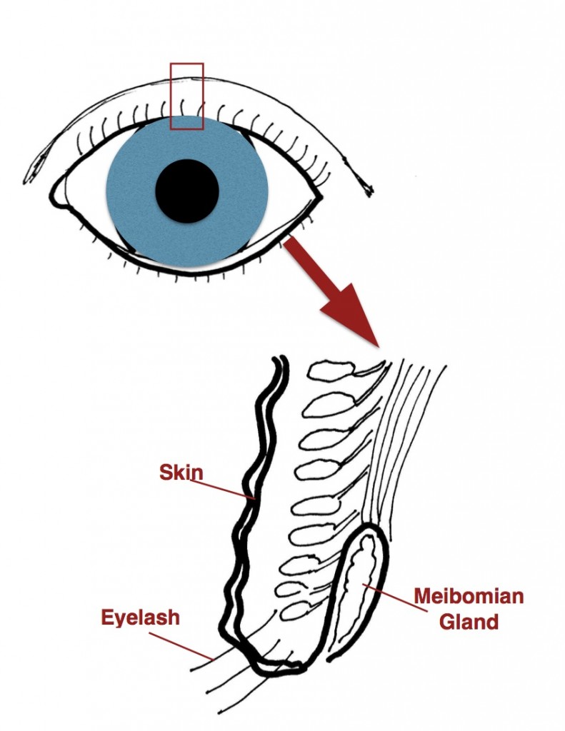 Meibomian gland picture jpeg